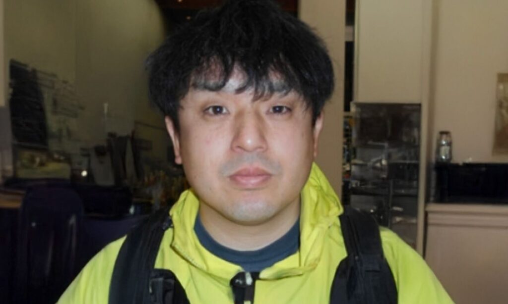 施術前の状態(Before):ヒゲが濃い時の写真(鼻下、顎髭が濃いです)