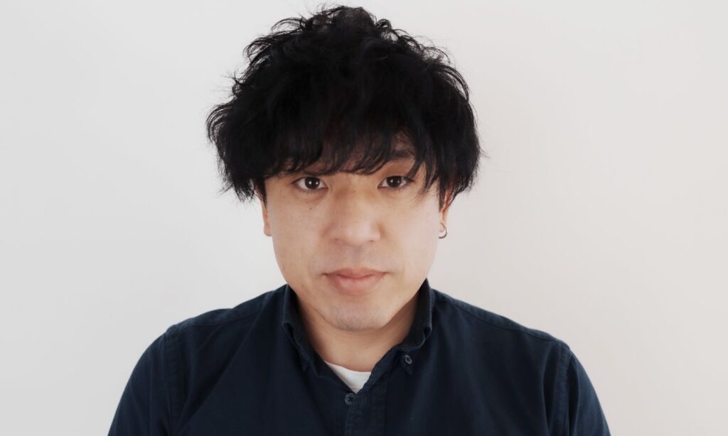 ヒゲ脱毛施術前の状態(After):6回目以降の瀬術後の写真です。