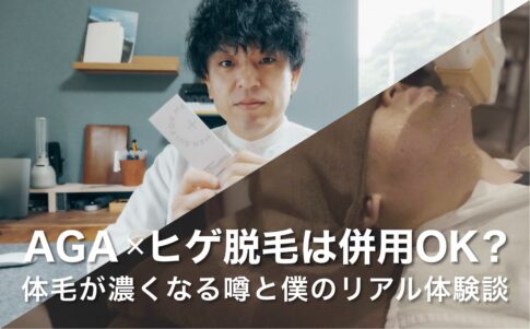 AGA×ヒゲ脱毛は併用OK？体毛が濃くなる噂と僕のリアル体験談