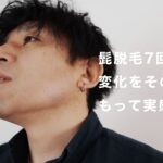 【ヒゲ脱毛7回目レビュー】40代男性が通って感じた「ここが分岐点」