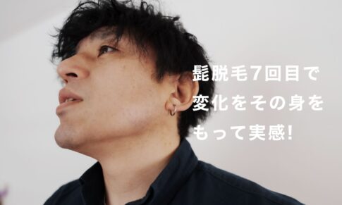 【ヒゲ脱毛7回目レビュー】40代男性が通って感じた「ここが分岐点」