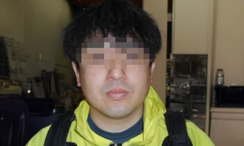 施術前の状態(Before):ヒゲが濃い時の写真(鼻下、顎髭が濃いです)