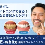 40代から始めるホワイトニング！研磨剤不使用で歯の黄ばみをケア【e-white】