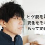 【ヒゲ脱毛8回目レビュー】ここまでの進捗と感想