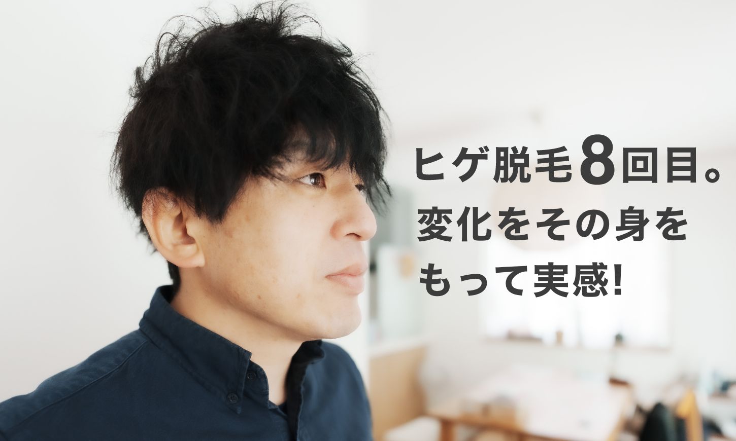 【ヒゲ脱毛8回目レビュー】ここまでの進捗と感想