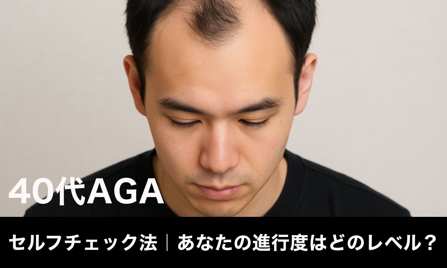 【40代AGA】セルフチェック法｜あなたの進行度はどのレベル？