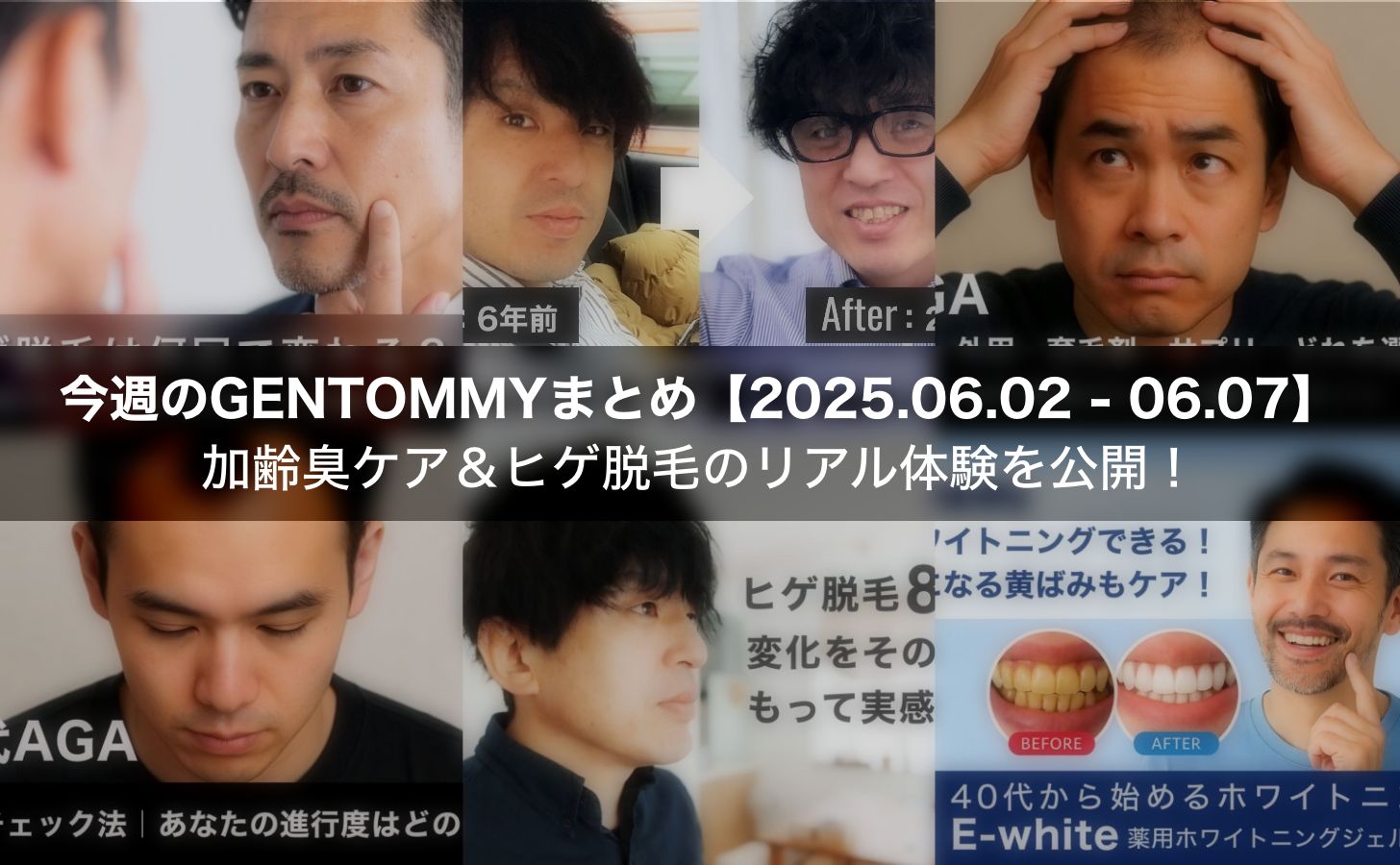 【40代メンズ美容まとめ】ヒゲ脱毛・AGA・ホワイトニング…実体験ベースの最新記事6選！