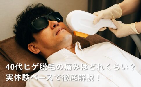 40代ヒゲ脱毛の痛みはどれくらい？実体験ベースで徹底解説！ 「