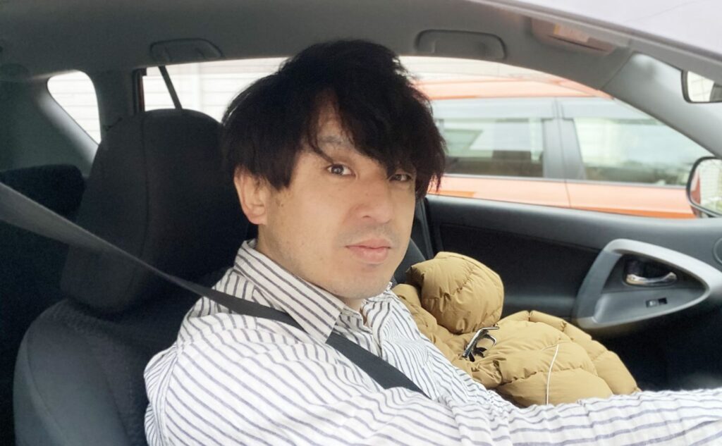 ヒゲ脱毛を始める前の写真:ジェントミー