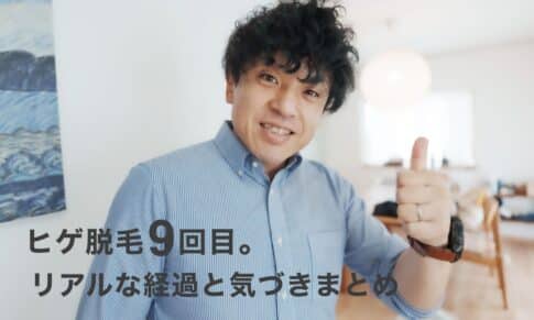 【40代からのヒゲ脱毛】9回目でここまで変わった！リアルな経過と気づきまとめ