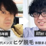 【完全版】40代メンズのヒゲ脱毛体験まとめ｜脱毛時の痛み・回数・おすすめアイテムまで