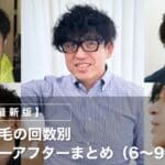 【最新版】ヒゲ脱毛の回数別ビフォーアフターまとめ（6〜9回目）