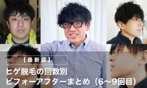【最新版】ヒゲ脱毛の回数別ビフォーアフターまとめ（6〜9回目）