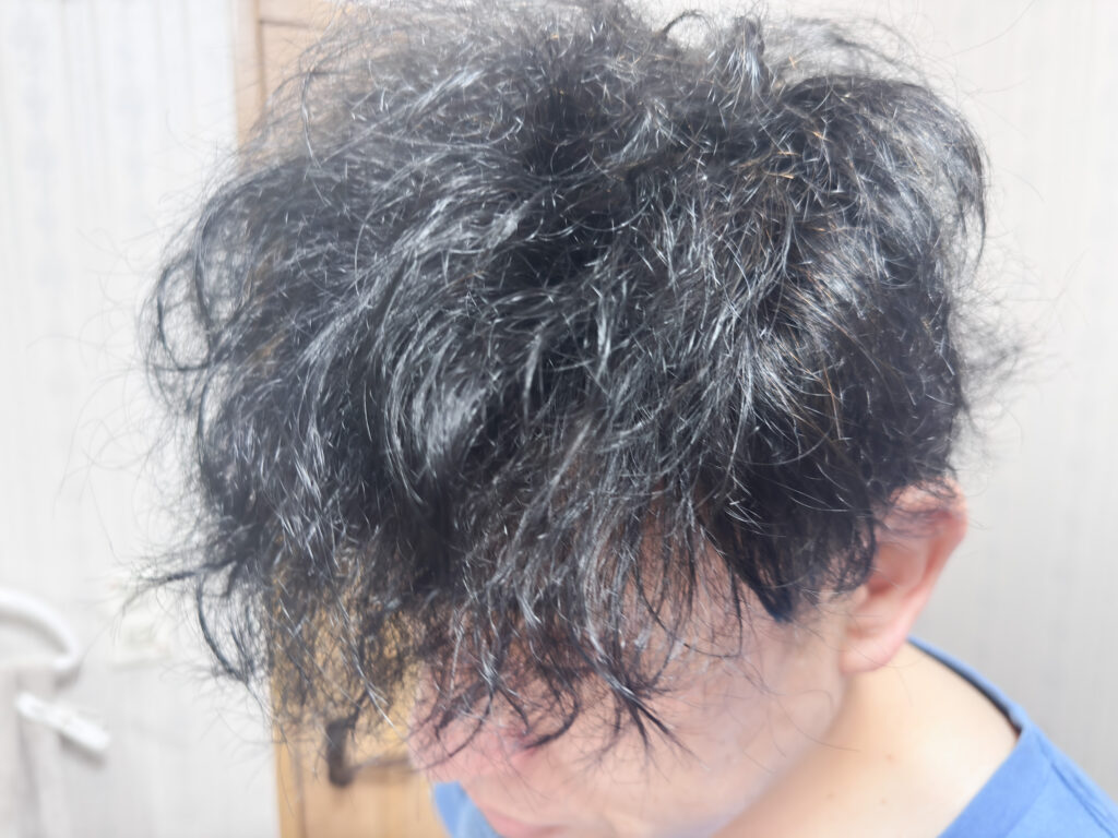 BOTANIST ボタニカルシャンプーを利用して2ヶ月の写真2