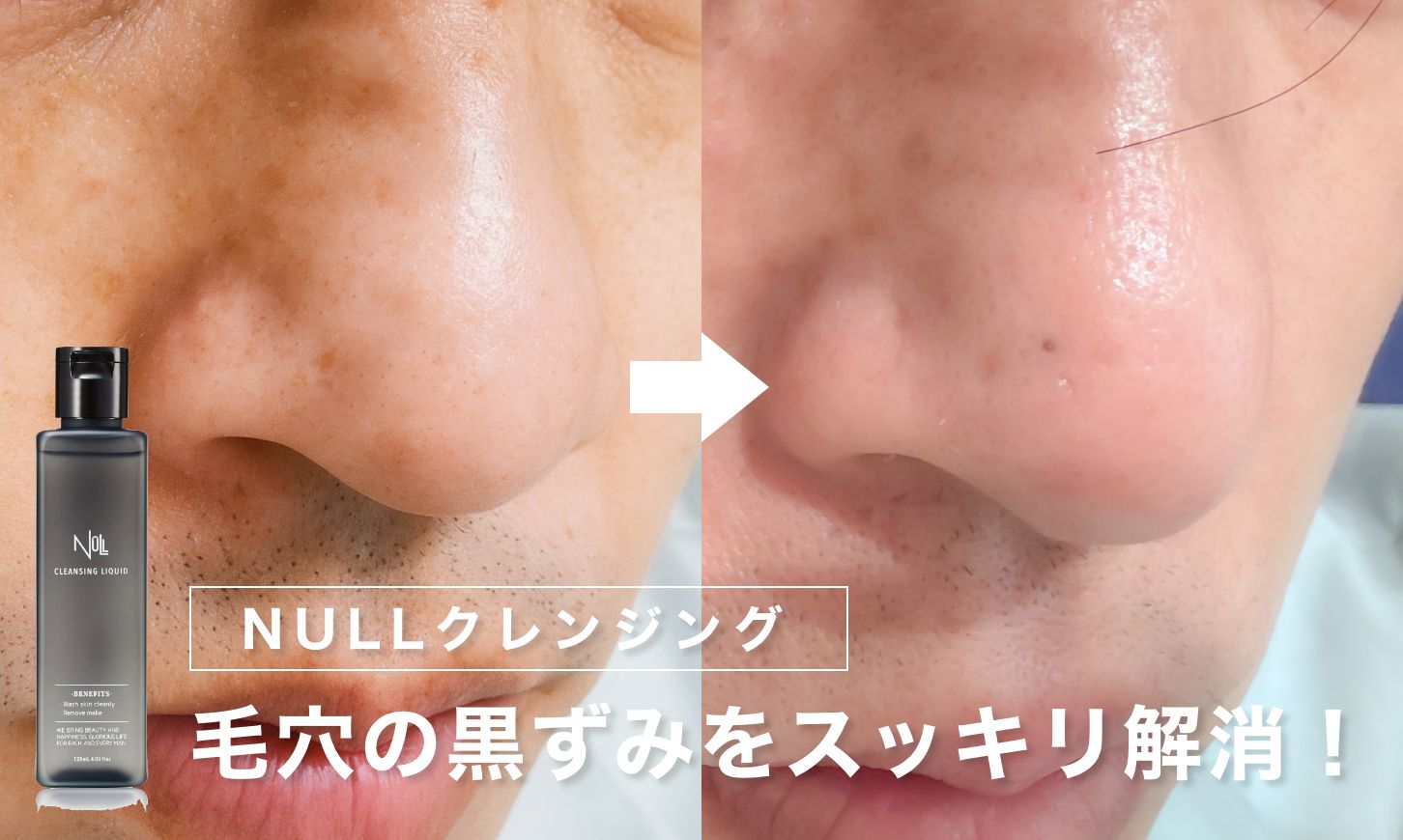 【40代男性必見】毛穴の黒ずみをスッキリ解消！NULLクレンジングリキッドを3週間使ってみた結果