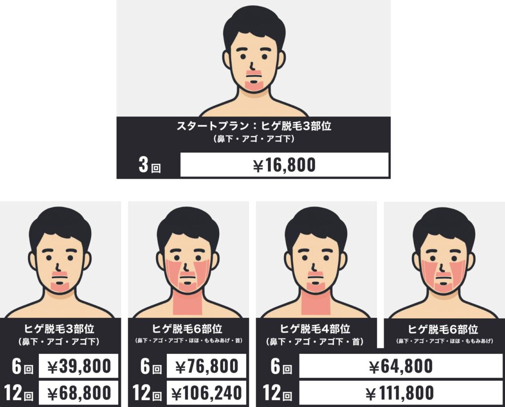 ゴリラ脱毛は料金体系