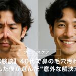 【体験談】40代で鼻の毛穴汚れに悩んだ僕が選んだ“意外な解決法”