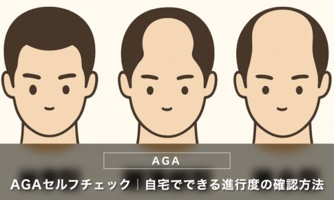 AGAセルフチェック｜自宅でできる進行度の確認方法