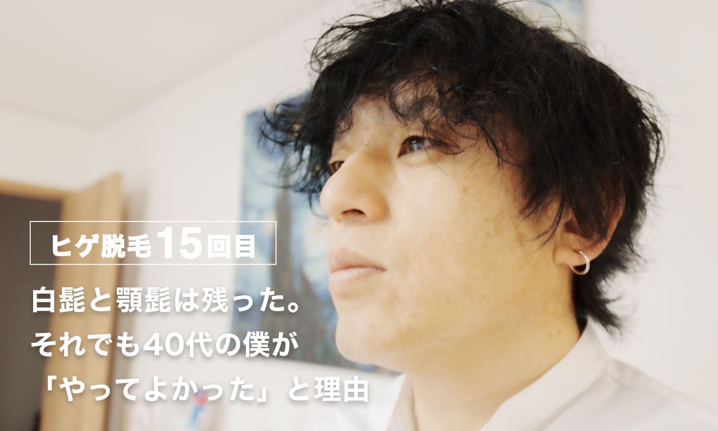 【ヒゲ脱毛15回目のリアル】白髭と顎髭は残った。それでも40代の僕が「やってよかった」と理由