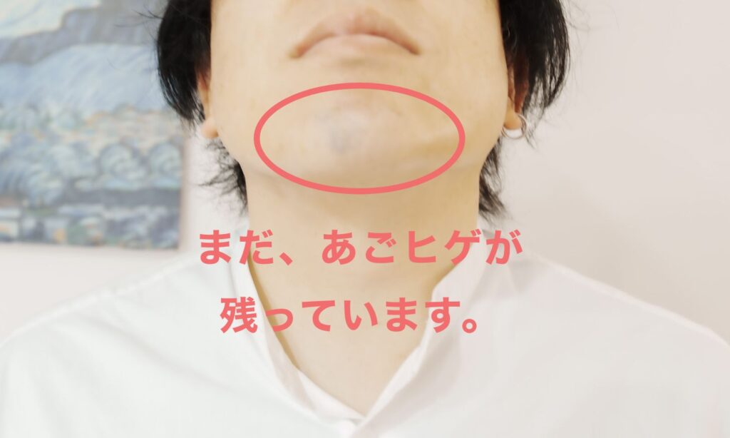 まだ、あごヒゲが残っている。