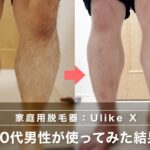【家庭用脱毛器】Ulike Xを40代男性が使ってみた結果｜太ももと膝下で見えた違い