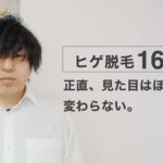 ヒゲ脱毛16回目。正直、見た目はほとんど変わらない