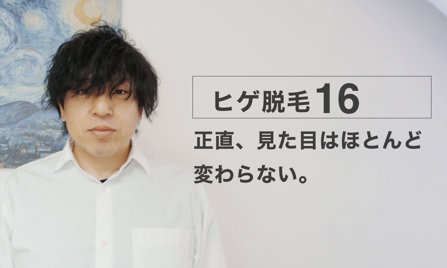 ヒゲ脱毛16回目。正直、見た目はほとんど変わらない